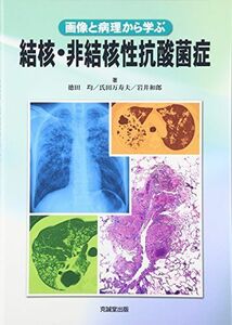 [A11451881]結核・非結核性抗酸菌症 [単行本（ソフトカバー）] 徳田 均、 氏田万寿夫; 岩井和郎