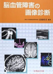 [A01439869]脳血管障害の画像診断 [単行本] 高橋 昭喜