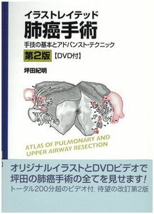 [A11079362]イラストレイテッド肺癌手術[DVD付]―手技の基本とアドバンスト・テクニック [大型本] 坪田　紀明