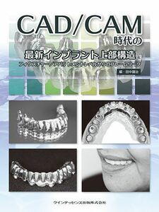 [A12184698]CAD/CAM時代の最新インプラント上部構造 田中 譲治