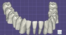 歯科　歯科技工　ex＿cad用　オリジナル .eoff　ティースライブラリー　No,7 _画像3