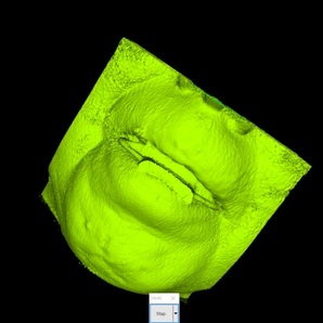 歯科 歯科技工 ダイコムデータから骨や歯のデータを抜き出す手順動画 mp4 CBCT の画像3