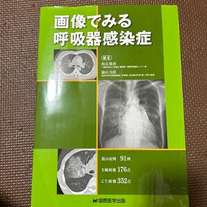 画像でみる呼吸器感染症 松島敏春／編　藤田次郎／編