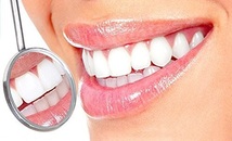 マウスピース/歯保護/歯列矯正/歯ぎしり/ いびき防止/ケース付/ソフト _画像3