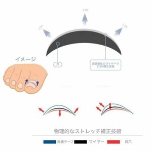 巻き爪 直しワイヤー 12本 6set 矯正器具 陥入爪矯正ワイヤー ステンレスの画像3