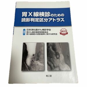 胃Ｘ線検診のための読影判定区分アトラス 日本消化器がん検診学会胃がん検診精度管理委員会胃Ｘ線検診の読影基準に関する研究会／編集