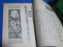 Y77)高1コース付録　真実の記録　公害が私のからだを奪った　昭和44年　水俣病、スモン病、四日市ぜんそく_画像4