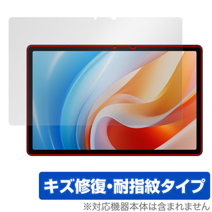 ALLDOCUBE iPlay 60 保護 フィルム OverLay Magic オールドキューブ アイプレイ 60 タブレット用保護フィルム 傷修復 耐指紋 指紋防止