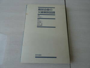 ★腹部血管のX線解剖図譜　医学書院　医学書　平松京一　/ 　中古現状品　 H03920