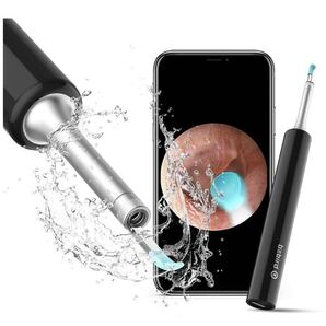 みみかき 耳かき カメラ付き 耳掃除 耳鏡 黒 300万画素 高画質180°回転