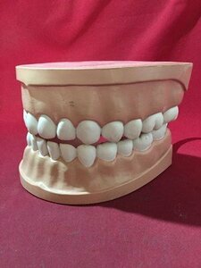 ｓ※8*　中古　歯磨き指導　顎模型　歯科　模型　歯科衛生士　見本　現状品　当時物　/ 奥