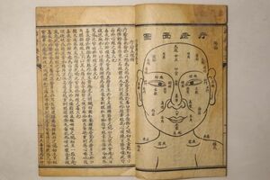 「治疔要書」上海宏大善書局 民国16年(1927年) 1冊｜唐本 石印本 鍼灸 医書 医学書 東洋医学 絵入り 漢籍 漢文 中国 古書 和本 古典籍 m71