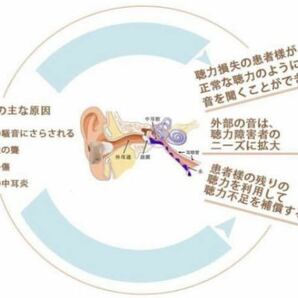 ☆最安値 補聴器 左右両用 デジタル 集音器 イヤホンキャップ 大小6種 肌色 軽量☆の画像5