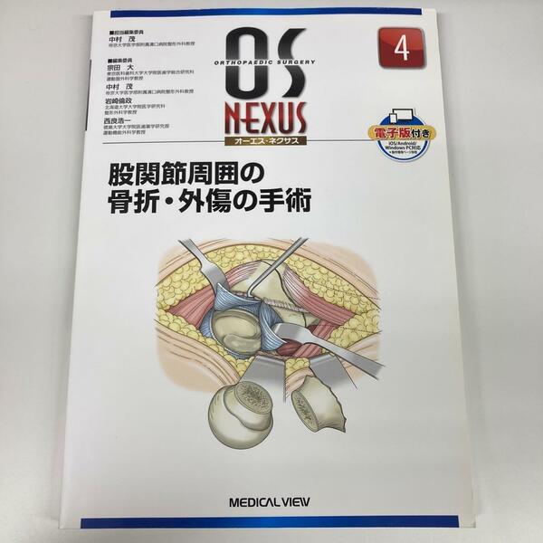 股関節周囲の骨折・外傷の手術　オーエスネクサス