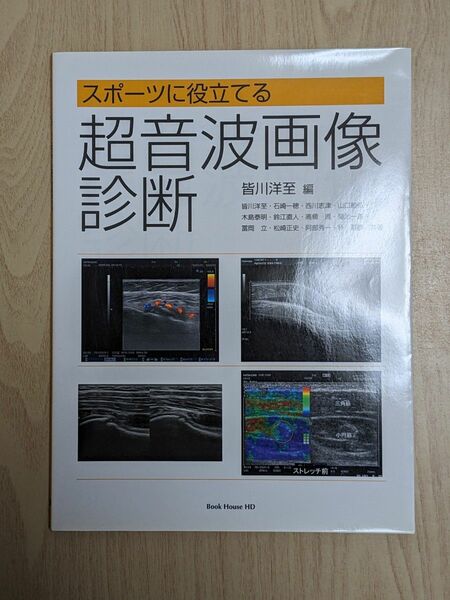 超音波画像診断