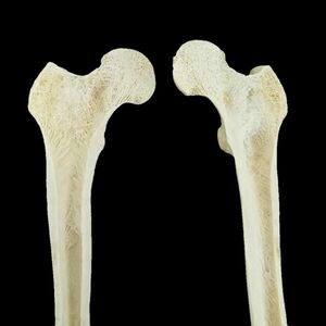 骨格標本　左大腿骨　海綿質　骨髄腔