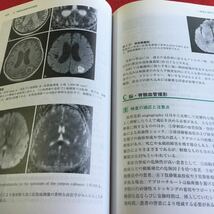 p-013 神経内科ハンドブック 鑑別診断と治療 第4版 医学書院※10_画像6