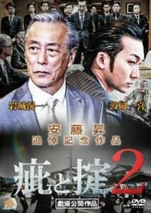 【ご奉仕価格】疵と掟 2 レンタル落ち 中古 DVD