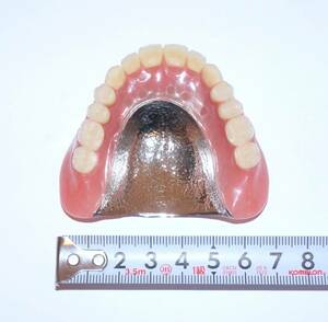 歯科 総義歯 金属床 サンプル 模型 見本 入れ歯 補綴 フルデンチャー 説明 技工 自費 メタル 資料 総入れ歯 インプラント