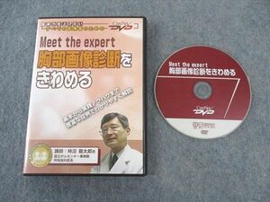 WK04-022 ケアネット Meet the expert 胸部画像診断をきわめる 2003 DVD1枚付 柿沼龍太郎 15s3D