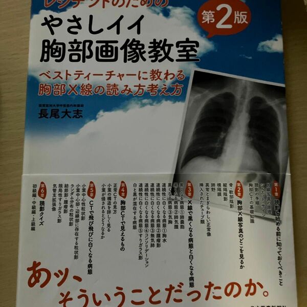 レジデントのためのやさしイイ胸部画像教室　ベストティーチャーに教わる胸部Ｘ線の読み方考え方 （レジデントのための） （第２版） 