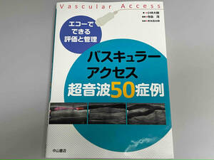 バスキュラーアクセス超音波50症例 小林大樹