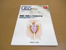 ●01)【同梱不可】開腹・閉腹と付属器手術/基本手技の完全マスター/OGS NOW 1/平松祐司/メジカルビュー社/2016年発行/A_画像1