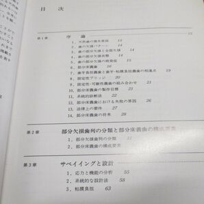 ▲01)【同梱不可】レンナーとバウチャーの部分床義歯の臨床/Removable partial dentures/Renner/Boucher/クインテッセンス出版/2000年/Aの画像4