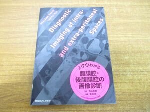 ●01)【同梱不可】よクウわかる腹膜腔・後腹膜腔の画像診断/浅山良樹/高司亮/メジカルビュー社/2022年発行/A