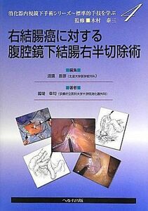 [A01134674]右結腸癌に対する腹腔境下結腸右半切除術