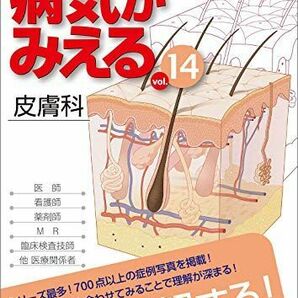 [A11691448]病気がみえる vol.14 皮膚科 [単行本（ソフトカバー）] 医療情報科学研究所の画像1