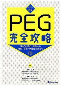 [A01852803]カラ-図解PEG完全攻略: 胃ろうの適応・禁忌から造設・管理・偶発症対策まで