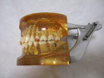 スケルトン 透明 顎 歯 歯科 疾患模型 100M_画像2