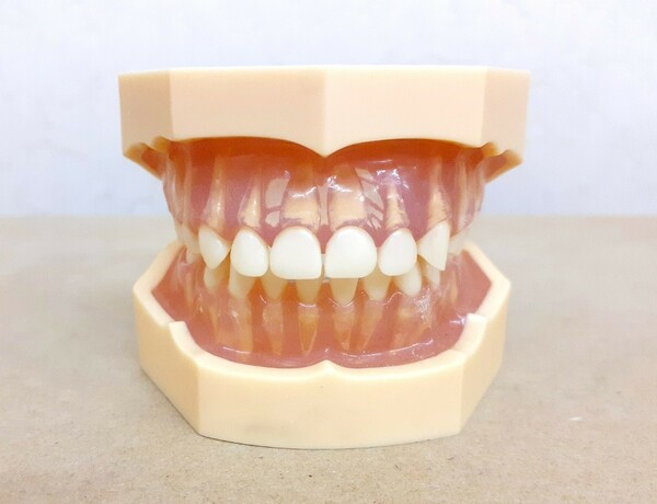 送料込み　NISSIN 複製歯牙着脱顎模型 乳歯 I31D-400F 小児 歯科 模型 顎模型 歯科衛生士 ニッシン マネキン 資料 ペリオ 説明 矯正