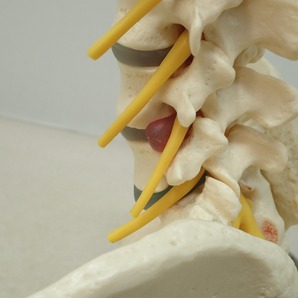 ∀全健会 骨格模型 小太郎君+日本カイロプラクティック連合会 腰椎変性の3段階 椎骨モデル まとめて2点set 脊柱模型 整体【FF；G0AB1002の画像6