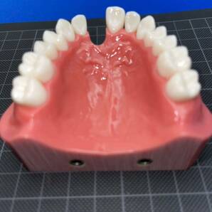 歯科用 顎模型の画像7