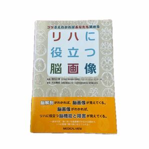 リハに役立つ脳画像　コツさえわかればあなたも読める （コツさえわかればあなたも読める） 酒向正春／監修　大村優慈／著