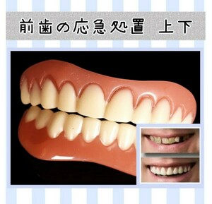 歯の応急処置　前歯のカバー