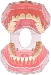 Angzhili 歯列模型 歯が抜く説明モデル 説明モデル 教学モデル 歯科インプラントモデル 上下顎模型 研究治療説明用 取り外