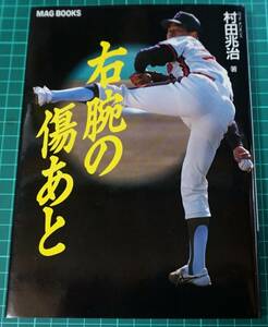 村田兆治★サイン入り★右腕の傷あと