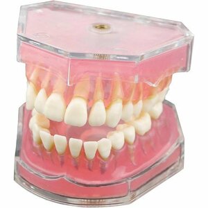 新品 EUSTOMA 教学用 医学研究治療説明用 取り外し可能 歯茎が柔らかい 上下顎1 歯が抜く説明モデル 歯列模型 135