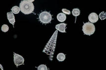 希少 バルバドス (Barbados) 島産 放散虫 (Radiolaria) 大型カバーグラス L011 プレパラート顕微鏡標本 微化石 微生物 プランクトン _画像1