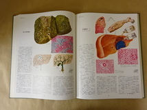 医学図譜集 消化器編（Ⅲ）丸善株式会社_画像3