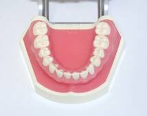 歯科 模型 ニッシン 複製歯牙着脱模型 12FE-A.A.2 顎模型 NISSIN マネキン 歯科衛生士 技工 資料 ペリオ 説明 2_画像8
