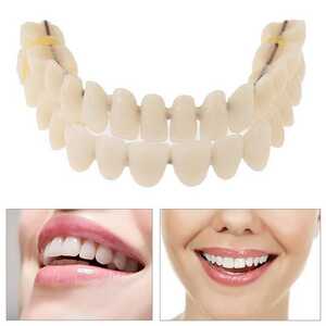  wire toe s difference . tooth whitening temporary tooth 