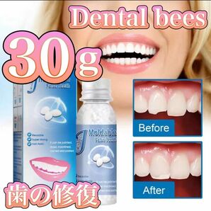 デンタルビーズ３０ 歯科ビーズ 歯の欠損修復 義歯 仮歯 つけ歯 入れ歯 差し歯 インスタントスマイル 多目的ビーズ