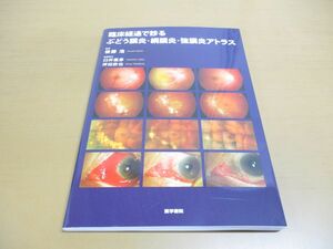 ●01)【同梱不可】臨床経過で診る ぶどう膜炎・網膜炎・強膜炎アトラス/後藤浩/臼井嘉彦/医学書院/2024年/A