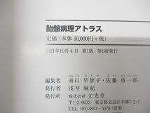 ●01)【同梱不可】胎盤病理アトラス/南口早智子/佐藤勇一郎/文光堂/2021年発行/A_画像4