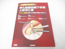 ●01)【同梱不可】消化器腹腔鏡下手術 上部消化管/ビジュアルサージカル/瀬戸泰之/Gakken/秀潤社/2023年/A_画像1