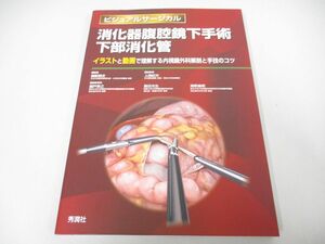 ●01)【同梱不可】消化器腹腔鏡下手術 下部消化管/ビジュアルサージカル/上西紀夫/学研プラス/秀潤社/2022年/A